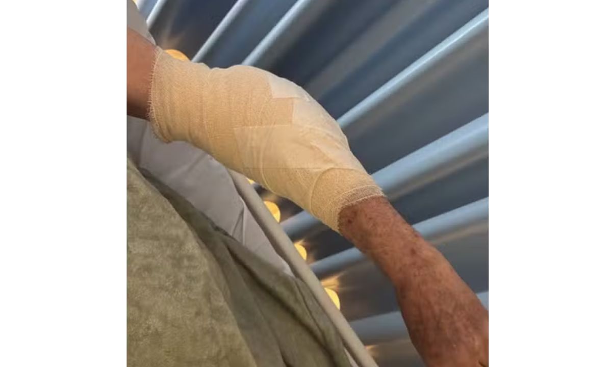 Idoso de 79 anos é atacado por pitbull na orla e precisa de mais de 20 pontos