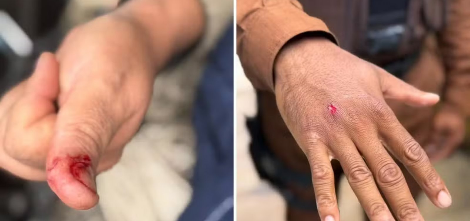 Macaco-prego invade condomínio em Salvador, bebe álcool e fere cinco pessoas