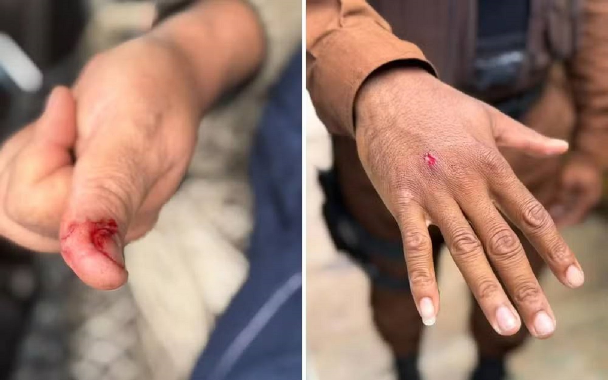 Pânico na Paralela: macaco-prego ingere álcool e remédios, invade condomínio e fere cinco